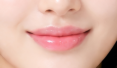 입술 필러 시술 부위 — 입술 볼륨을 더하는 볼륨 디자인