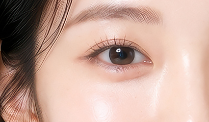 눈밑 필러 시술 부위 — 꺼진 눈밑을 채우는 볼륨 디자인