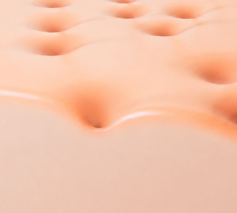 레이저 제모 시술 — 매끈하고 깨끗한 피부 클로즈업