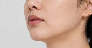 네오젠 플라즈마 피부탄력 개선 시술 부위